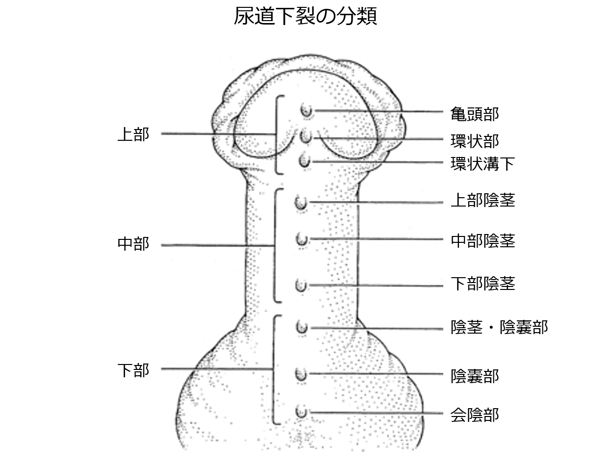 亀頭 割れ目